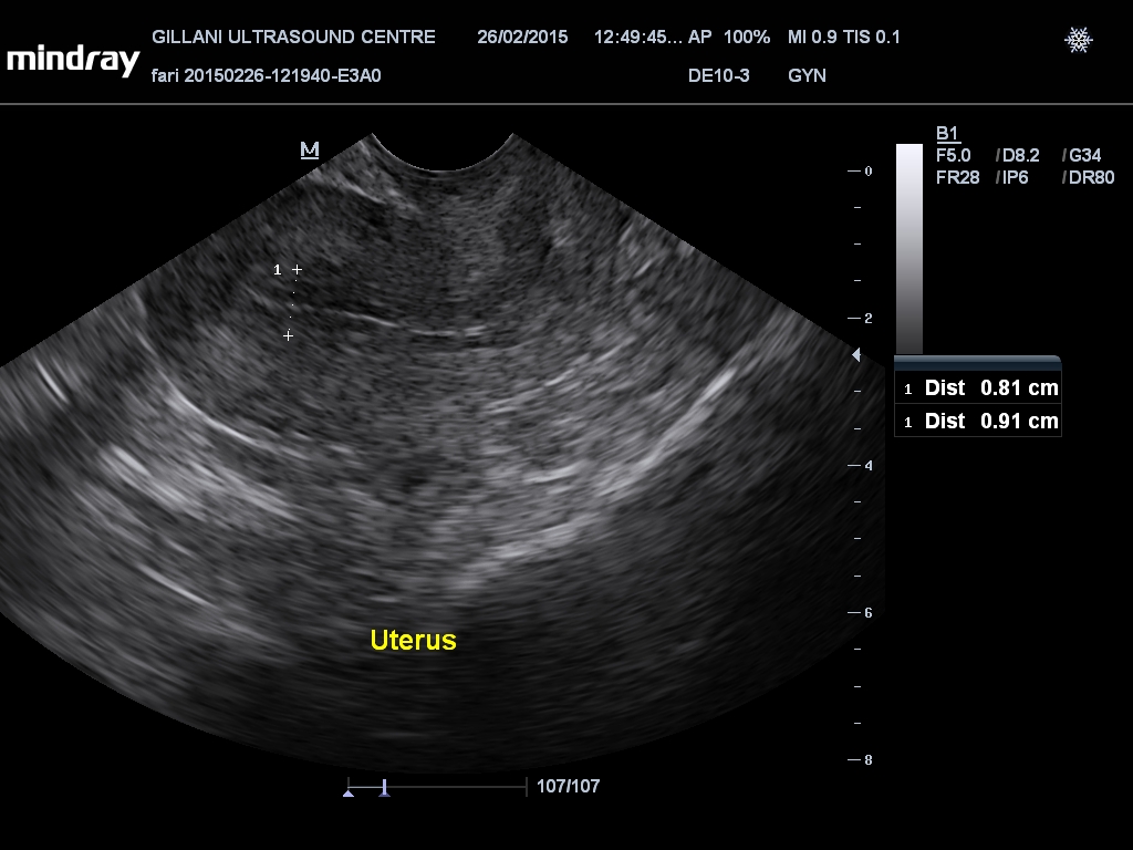 201502261249520019GYN