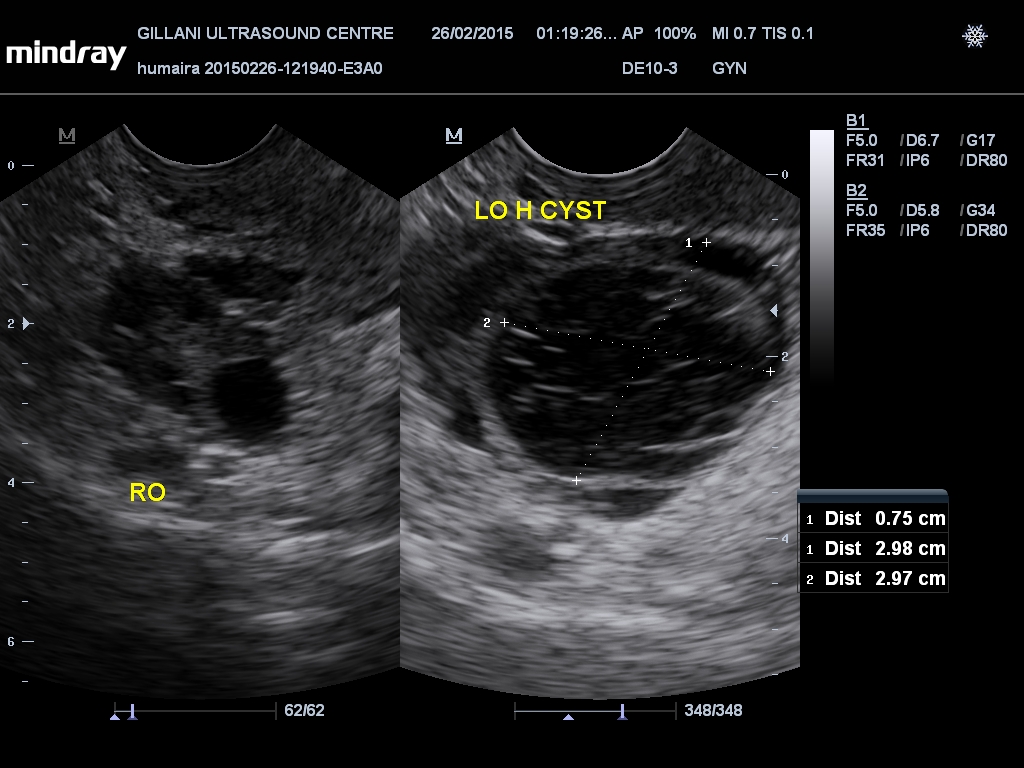 201502261319470025GYN