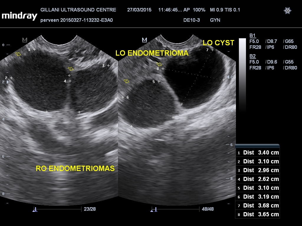 201503271148240009GYN