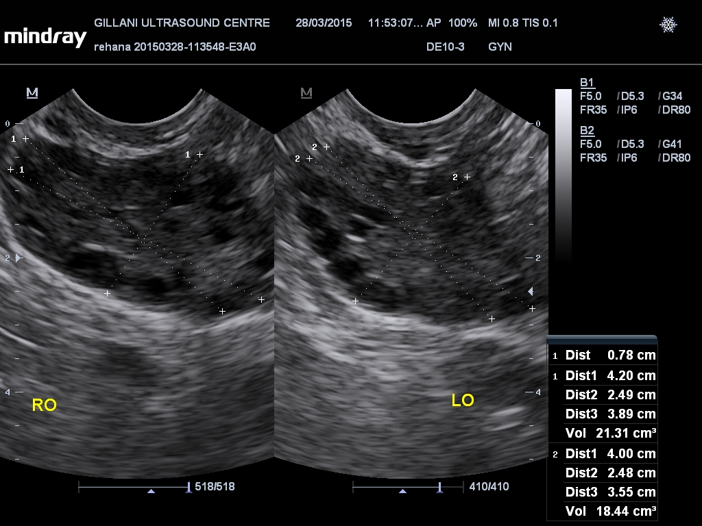201503281153390012GYN